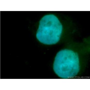 SMARCD1 Rabbit Polyclonal Antibody (10998-2-AP)
