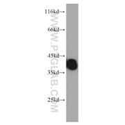 TPM3 Rabbit Polyclonal Antibody (10737-1-AP)