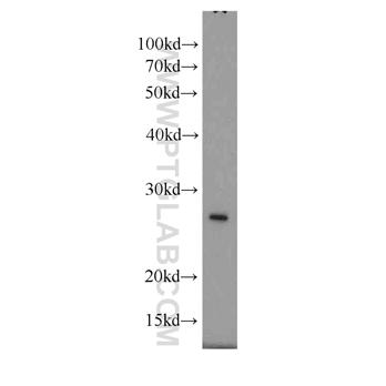 GAMT Rabbit Polyclonal Antibody (10880-1-AP)