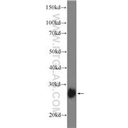 TPK1 Rabbit Polyclonal Antibody (10942-1-AP)