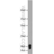 PPIA Rabbit Polyclonal Antibody (10720-1-AP)