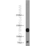 ITGA5 Rabbit Polyclonal Antibody (10569-1-AP)