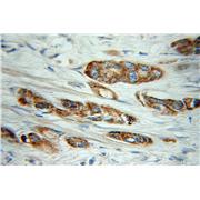COG3 Rabbit Polyclonal Antibody (11130-1-AP)