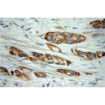 COG3 Rabbit Polyclonal Antibody (11130-1-AP)