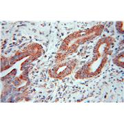 PPP1CC Rabbit Polyclonal Antibody (11082-1-AP)
