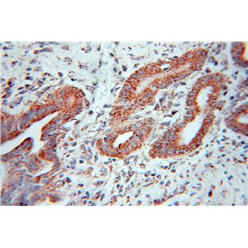 PPP1CC Rabbit Polyclonal Antibody (11082-1-AP)
