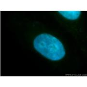 SFRS7 Rabbit Polyclonal Antibody (11044-1-AP)