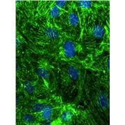 SEPT9 Rabbit Polyclonal Antibody (10769-1-AP)