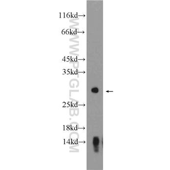 KLK2 Rabbit Polyclonal Antibody (10812-1-AP)