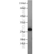 GMNN Rabbit Polyclonal Antibody (10802-1-AP)