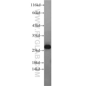 GMNN Rabbit Polyclonal Antibody (10802-1-AP)