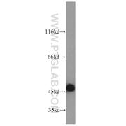 KRT18 Rabbit Polyclonal Antibody (10830-1-AP)