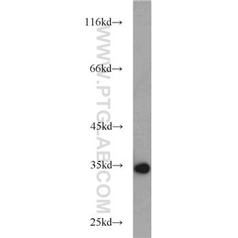 ANXA5 Rabbit Polyclonal Antibody (11060-1-AP)