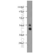 TBX22 Rabbit Polyclonal Antibody (11133-1-AP)