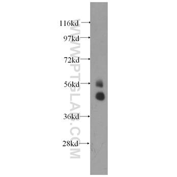 TBX22 Rabbit Polyclonal Antibody (11133-1-AP)
