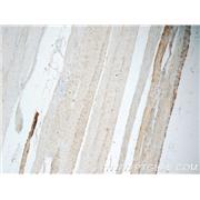 CHRNA1 Rabbit Polyclonal Antibody (10613-1-AP)