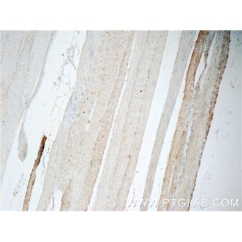 CHRNA1 Rabbit Polyclonal Antibody (10613-1-AP)