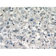 DDX5 Rabbit Polyclonal Antibody (10804-1-AP)