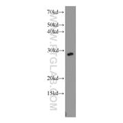 DCUN1D1 Rabbit Polyclonal Antibody (10965-1-AP)