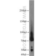 LUM Rabbit Polyclonal Antibody (10677-1-AP)