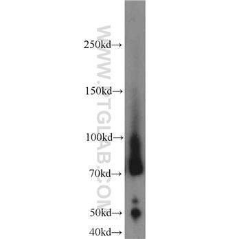 LUM Rabbit Polyclonal Antibody (10677-1-AP)