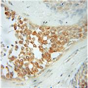 PLDN Rabbit Polyclonal Antibody (10891-2-AP)