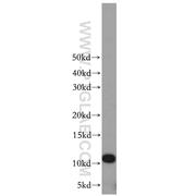 LSM5 Rabbit Polyclonal Antibody (10700-1-AP)