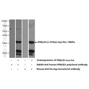 PRELID1 Rabbit Polyclonal Antibody (10877-1-AP)