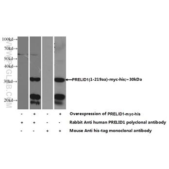 PRELID1 Rabbit Polyclonal Antibody (10877-1-AP)