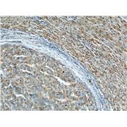 PHB Rabbit Polyclonal Antibody (10787-1-AP)