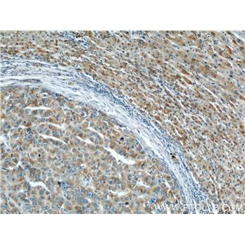 PHB Rabbit Polyclonal Antibody (10787-1-AP)