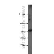 PICK1 Rabbit Polyclonal Antibody (10983-2-AP)