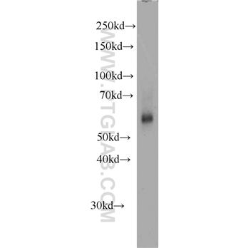 KMO Rabbit Polyclonal Antibody (10698-1-AP)
