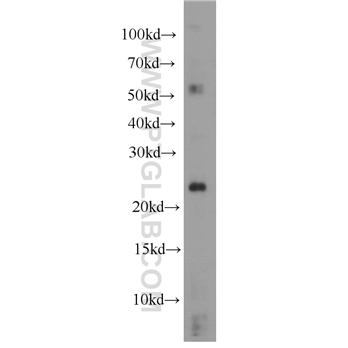 RHOC Rabbit Polyclonal Antibody (10632-1-AP)
