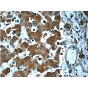 SND1 Rabbit Polyclonal Antibody (10760-1-AP)