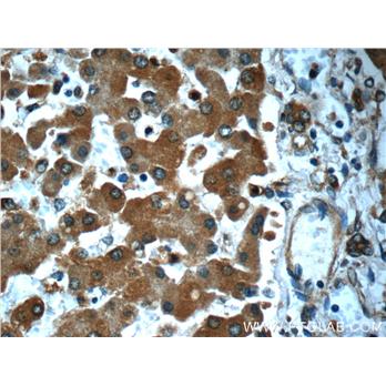 SND1 Rabbit Polyclonal Antibody (10760-1-AP)