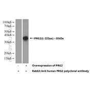 PRG2 Rabbit Polyclonal Antibody (10766-1-AP)
