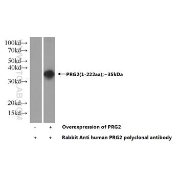 PRG2 Rabbit Polyclonal Antibody (10766-1-AP)