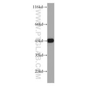 CSNK2A1 Rabbit Polyclonal Antibody (10992-1-AP)