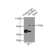 HADHA Rabbit Polyclonal Antibody (10758-1-AP)