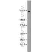 CDK5RAP3 Rabbit Polyclonal Antibody (11007-1-AP)