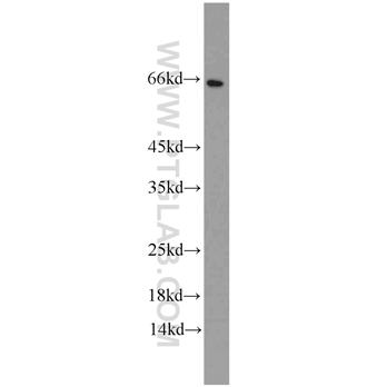 CDK5RAP3 Rabbit Polyclonal Antibody (11007-1-AP)