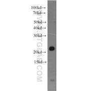 BID Rabbit Polyclonal Antibody (10988-1-AP)