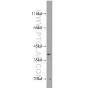 MAB21L2 Rabbit Polyclonal Antibody (10971-1-AP)