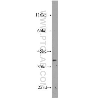 MAB21L2 Rabbit Polyclonal Antibody (10971-1-AP)