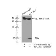 HPCAL1 Rabbit Polyclonal Antibody (10989-1-AP)