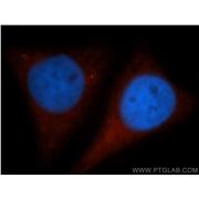 GYS1 Rabbit Polyclonal Antibody (10566-1-AP)