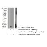 POLR3K Rabbit Polyclonal Antibody (11084-1-AP)
