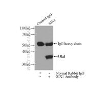 SIX1 Rabbit Polyclonal Antibody (10709-1-AP)
