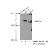 TPM2 Rabbit Polyclonal Antibody (11038-1-AP)